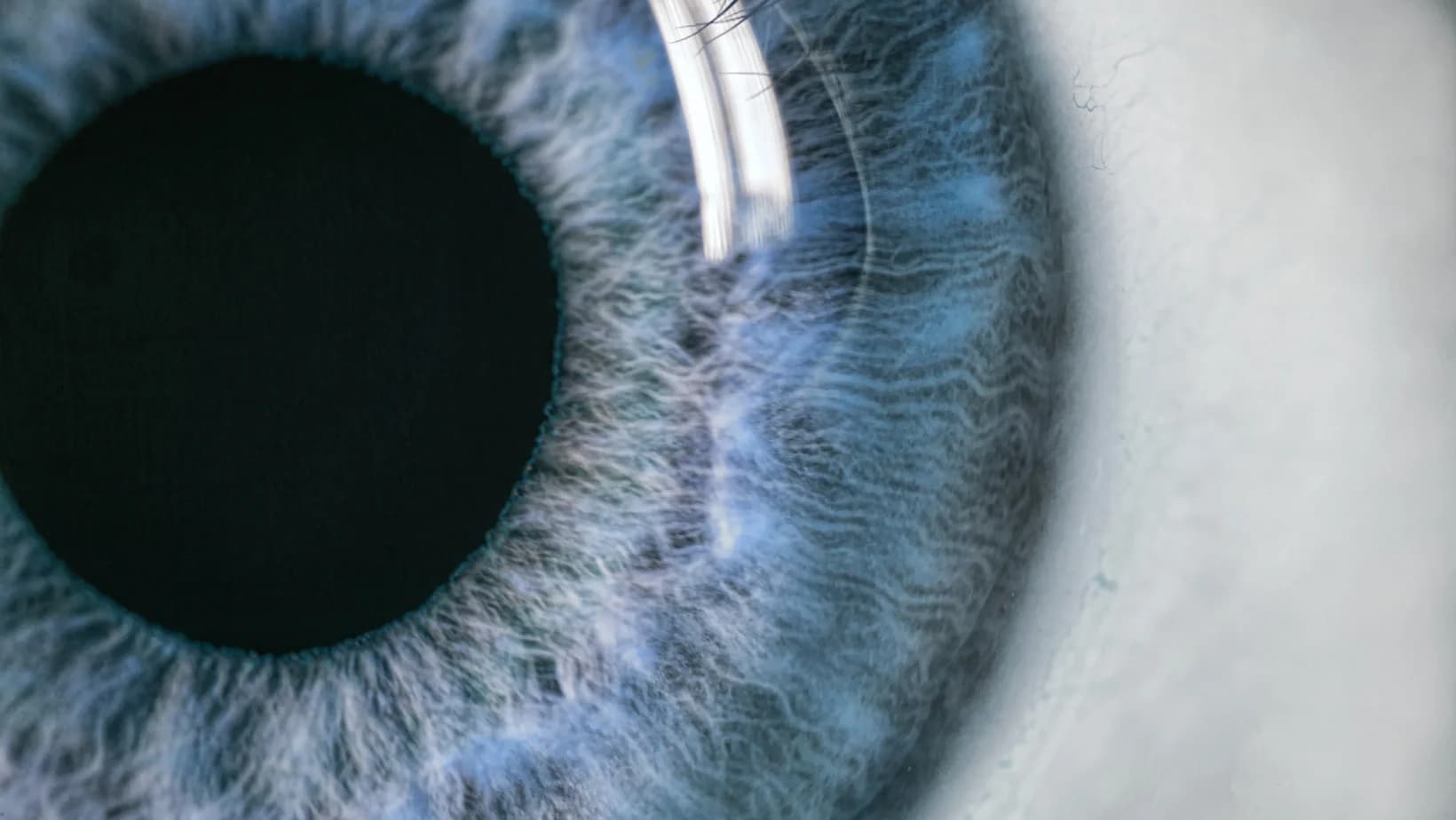 Terapia IPL doare? Ce trebuie să știi înainte de prima ședință