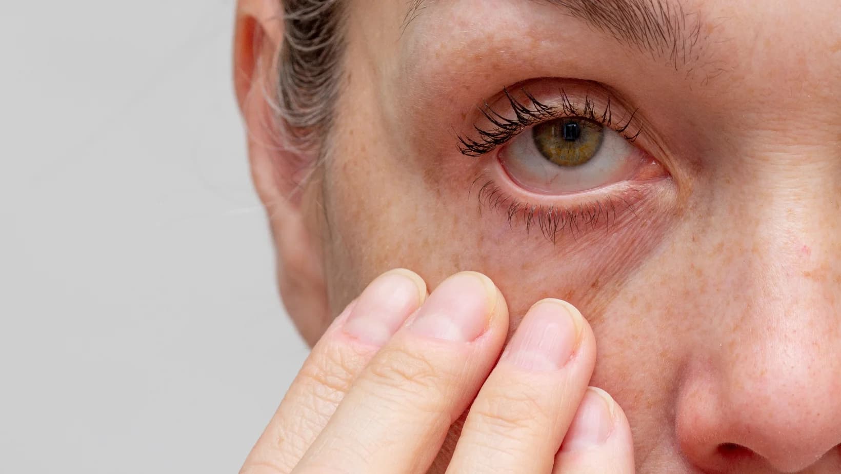 Cum sa prelungesti efectele Terapiei Resono-Rexon Eye?