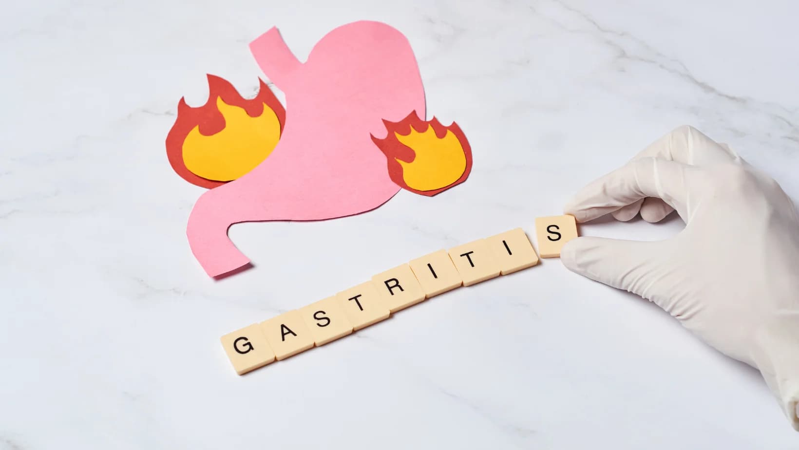 Gastrita: Cum sa o recunosti si ce solutii ofera gastroenterologia moderna