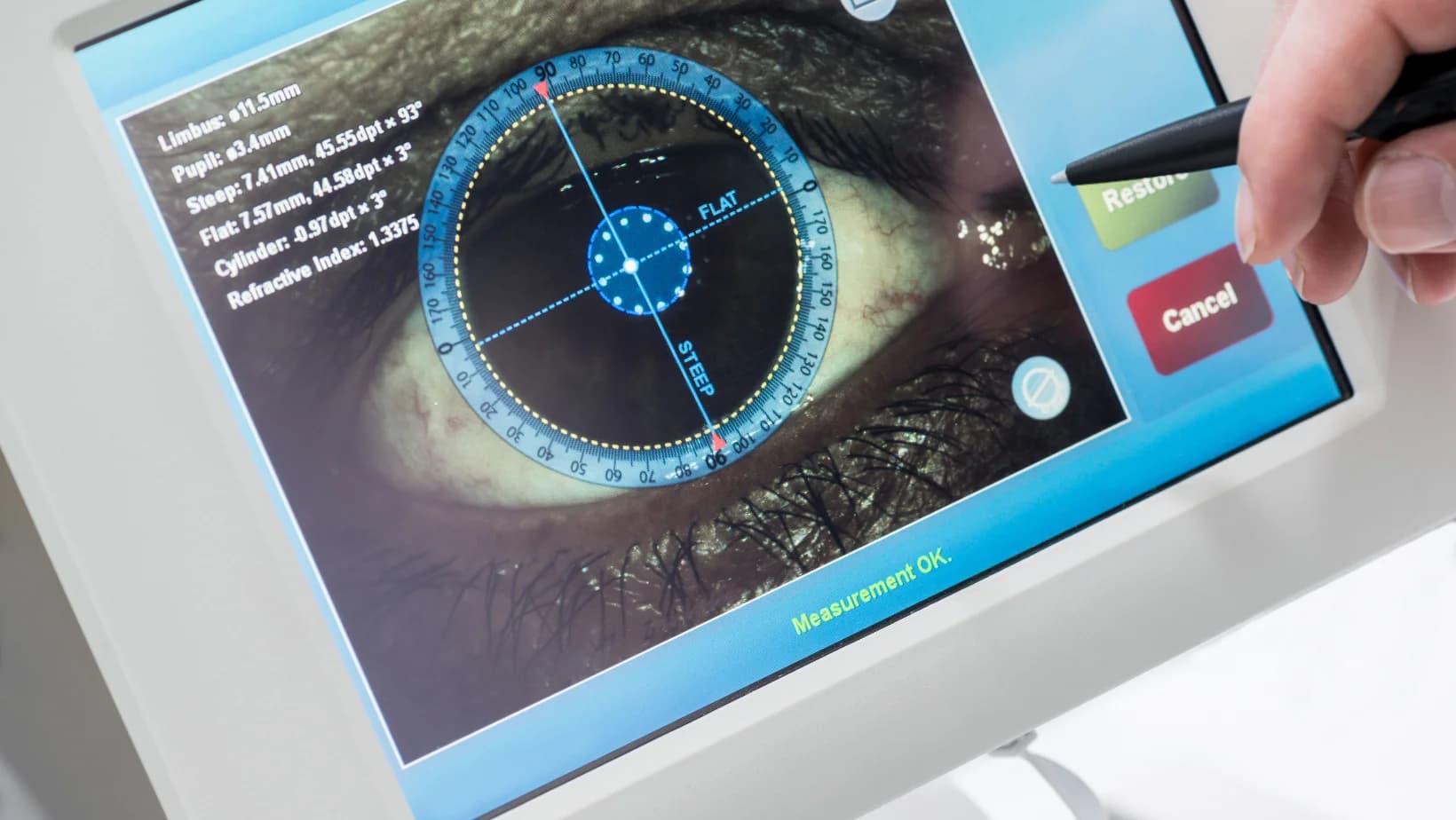 Mituri despre chirurgia oculara: Separam adevarul de fictiune